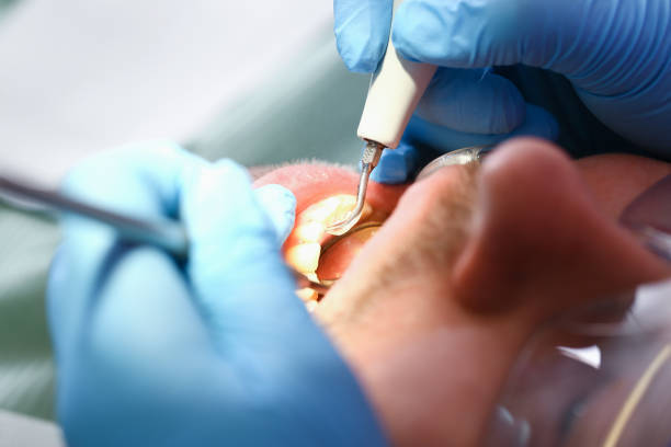 Best Holiday Emergency Dentist in Hamshire, TX