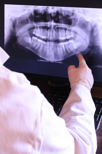 Best Emergency Dental Care for Abscessed Tooth in Hamshire, TX