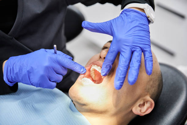 Best Emergency Dental Extractions in Hamshire, TX