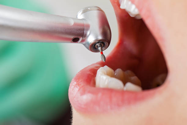 Best 24-Hour Emergency Dentist in Hamshire, TX